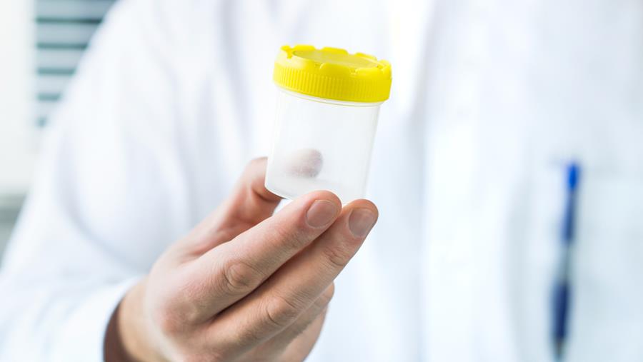 Regering schaft verplichte anonimiteit van spermadonoren af